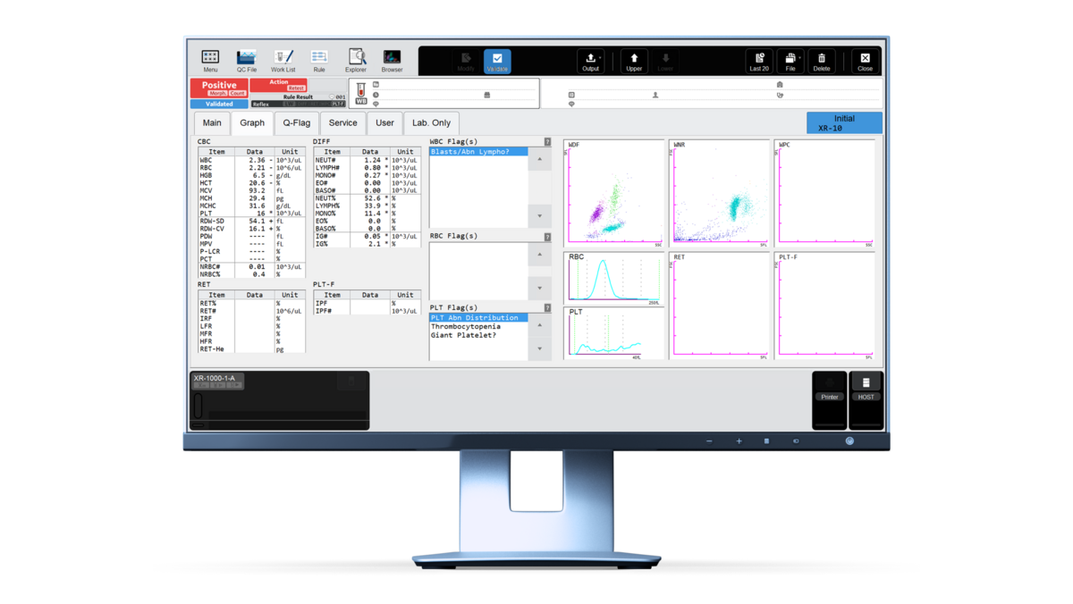 Abb. 1 Hämatologie-Laborergebnisse in der grafischen Darstellung des XR-Analysesystems.