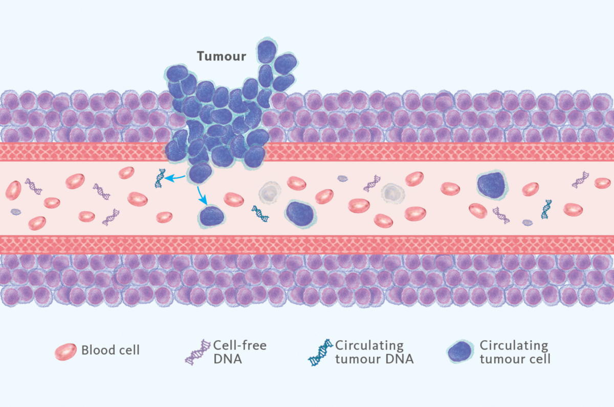 [.AT-de Austria (german)] Liquid biopsy