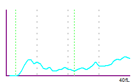 Abb. 2 PLT-Histogramm mit anomaler Verteilung.